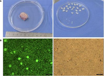 Ovarian tissue cryopreservation in the pediatric with rare diseases- experience from China’s first and the largest ovarian tissue cryobank